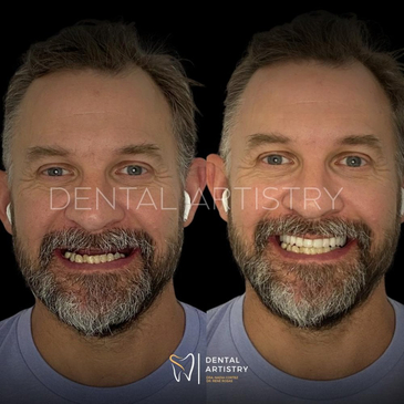 Slider image (10) Dental Artistry Dental Center